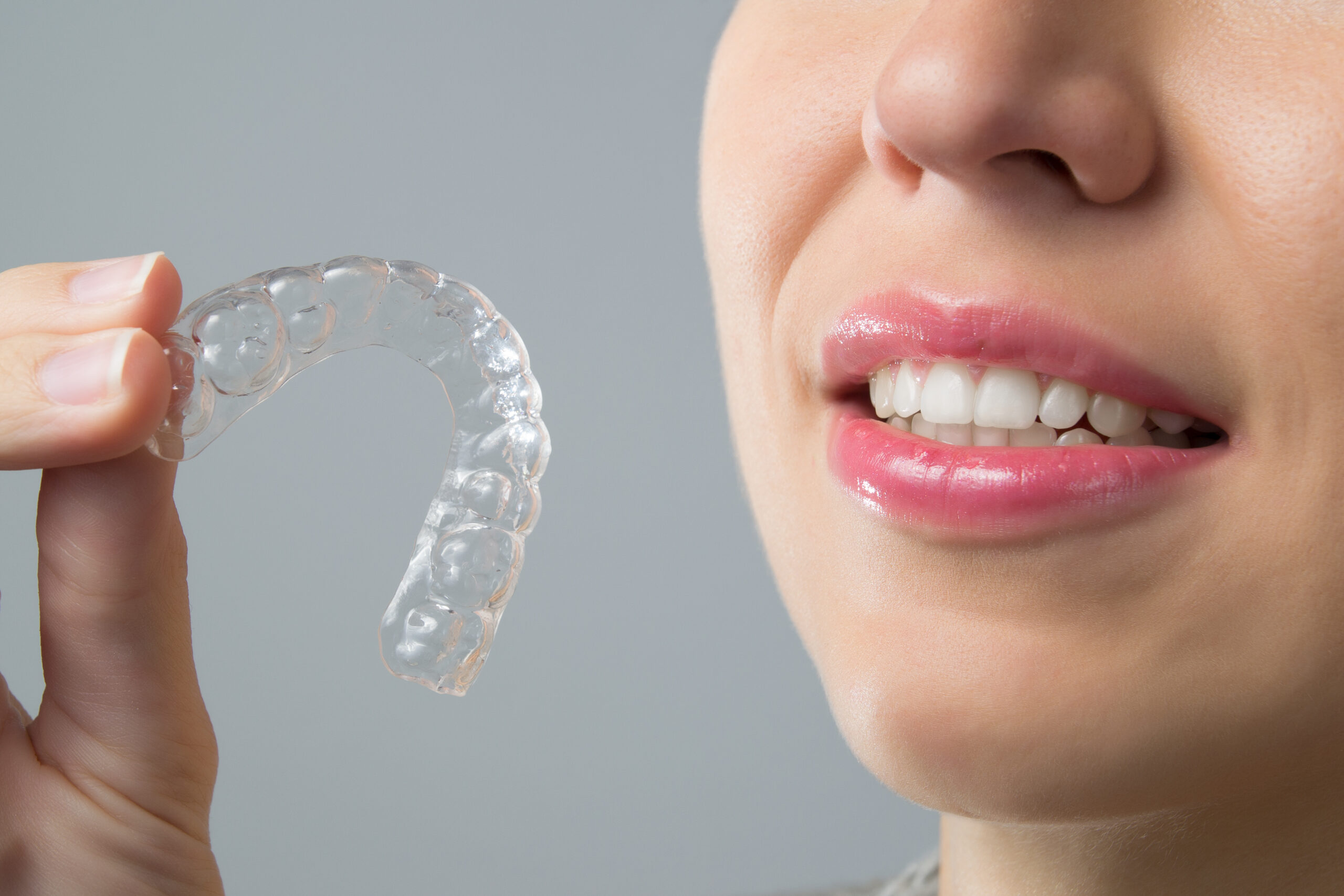 Invisalign. Каппы Инвизилайн. 3д Смайл элайнеры. Элайнеры ортодонтия. Элайнеры Invisalign.